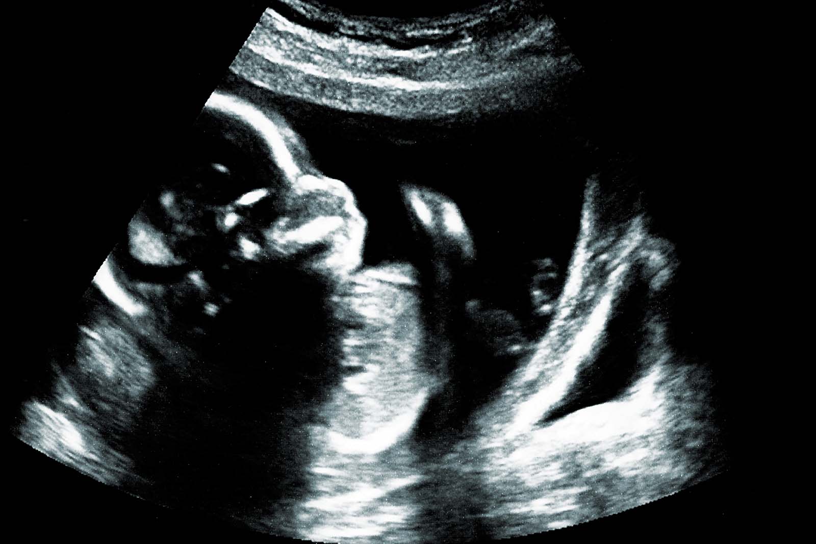 Missouri Constitution debate over SJR 8 and the New Amendment 3